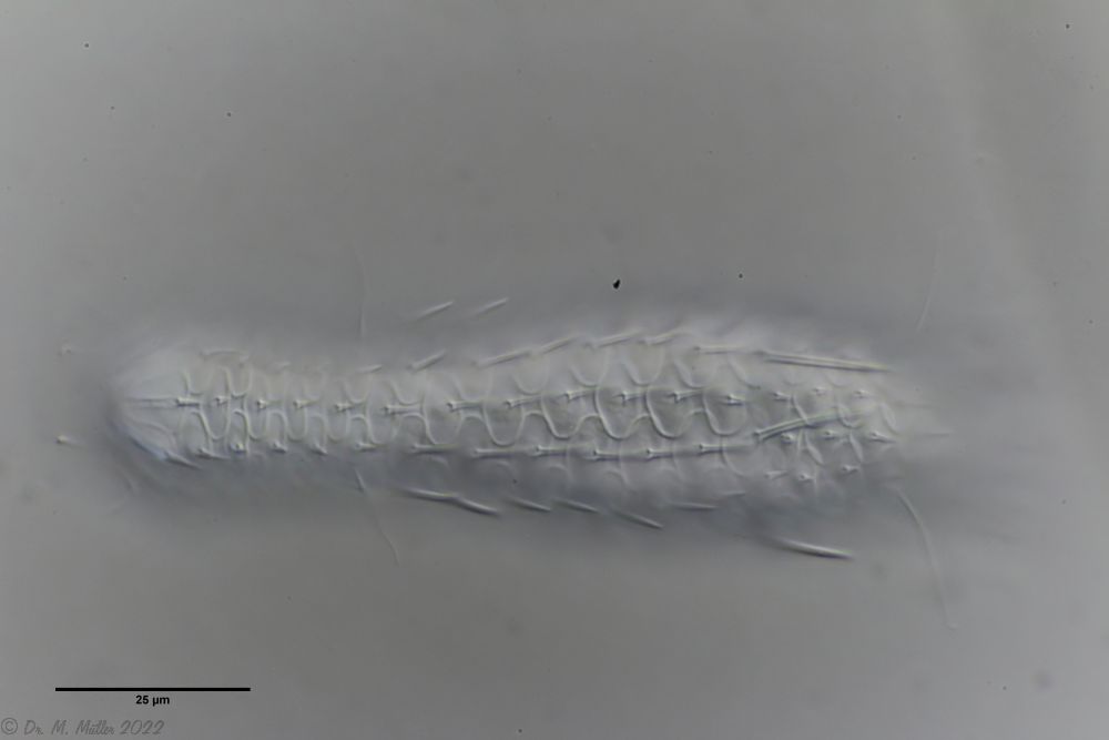 Dorsal