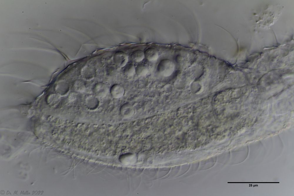 Parasiten